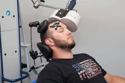 TMS Therapy