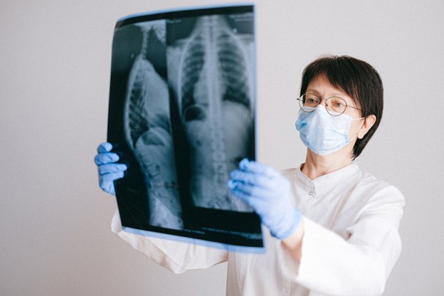 Understanding New York Laws for Mesothelioma Claims Guide