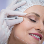 Beyond Wrinkles: Surprising Ways Botox Roseville Can Enhance Your Look