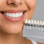Complete Smile Care: A Guide to Modern Dental Restoration Options