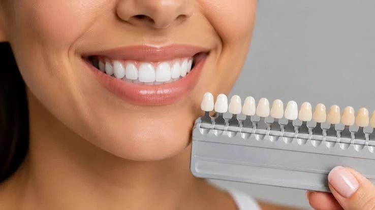 Complete Smile Care: A Guide to Modern Dental Restoration Options