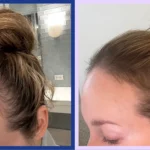 Hair Growth Tablets for Women with Thin, Fine Hair