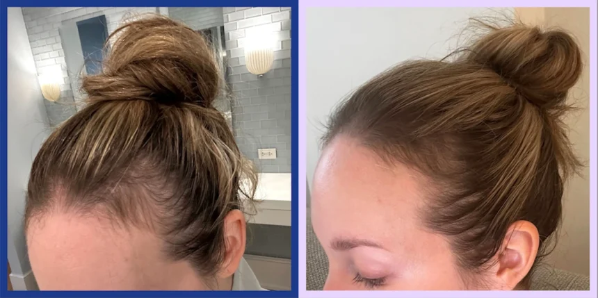 Hair Growth Tablets for Women with Thin, Fine Hair